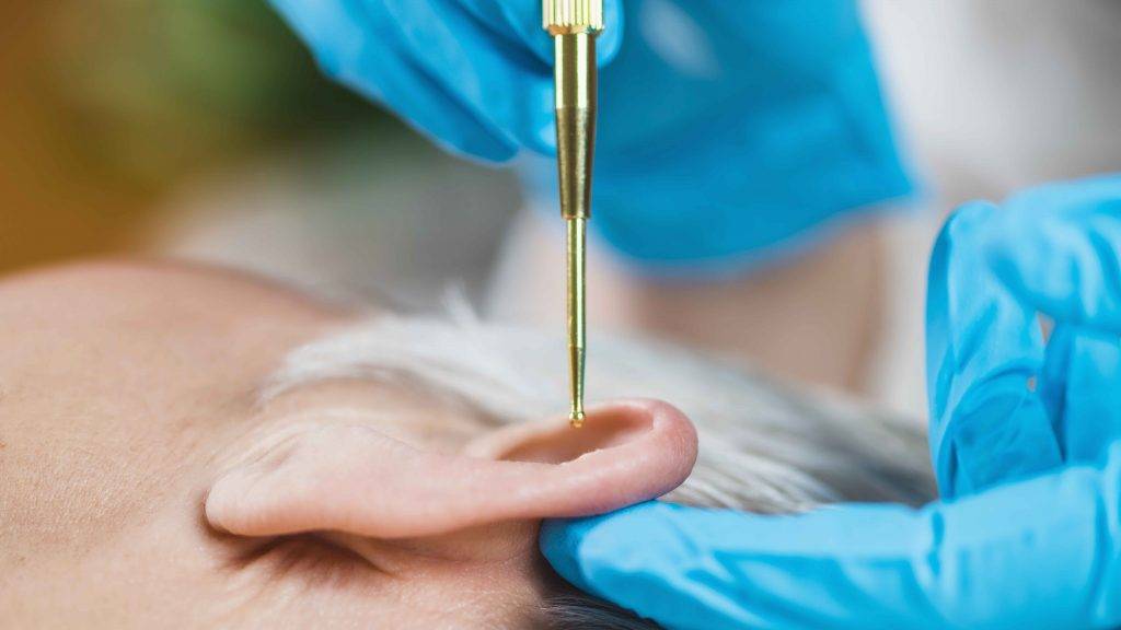 Curso de Auriculoterapia Auriculopuntura 2 Auriculoterapia curso tratamiento auriculopuntura
