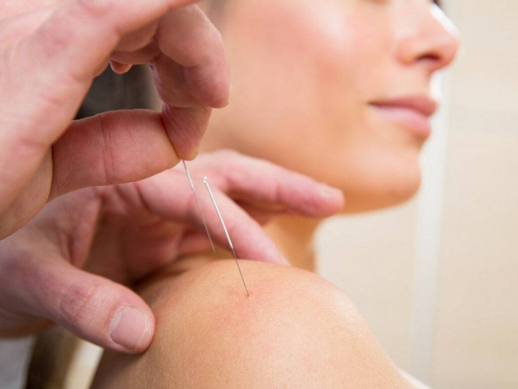 Curso MTC en San Fernando Cadiz 2 Acupuntor en San Fernando Cadiz